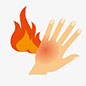 Burns
